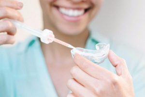 Η λεύκανση είναι μια από τις πιο δημοφιλείς οδοντιατρικές διαδικασίες που σχετίζονται με την αισθητική οδοντιατρική, επειδή μπορεί να βελτιώσει σημαντικά την εμφάνιση των δοντιών σας.